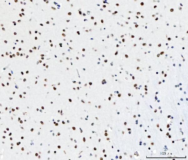 IHC - Anti-CPSF6 Antibody Picoband™ (monoclonal, 3F11E1) ABO16592